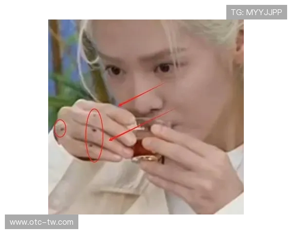 足球明星因意外受伤手指断裂的真实照片曝光引发广泛关注和讨论